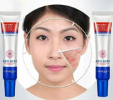 کرم ضد جوش اورژانسی