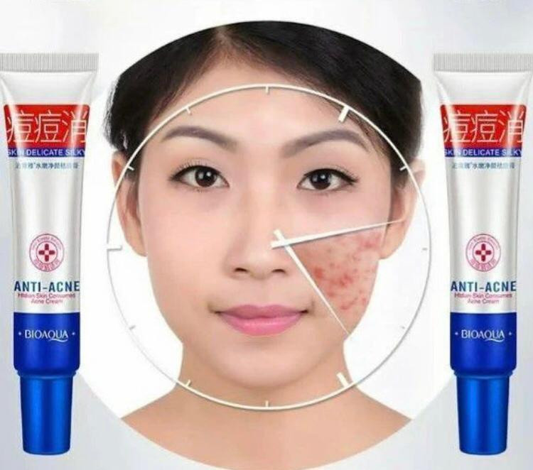 کرم ضد جوش اورژانسی