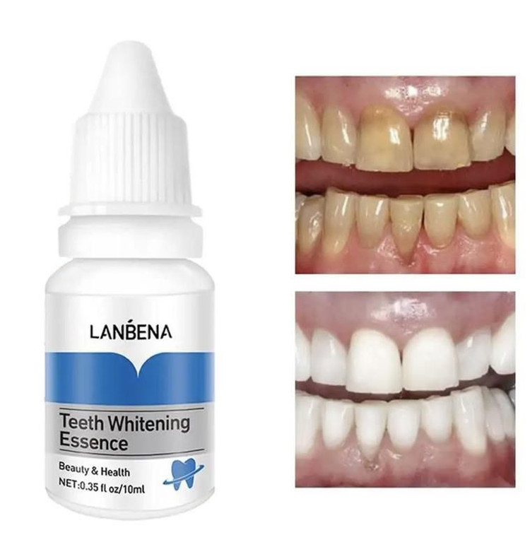 محلول سفید و درخشان کننده دندان لانبنا