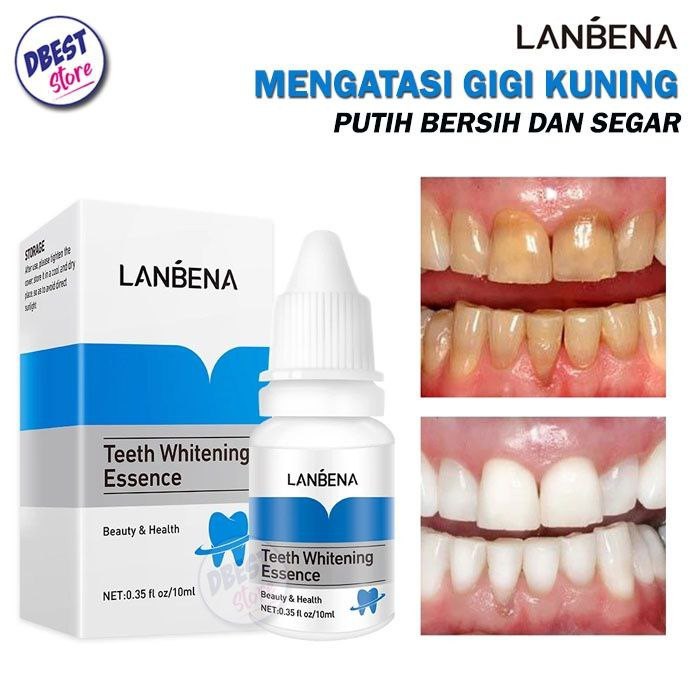 محلول سفید و درخشان کننده دندان لانبنا